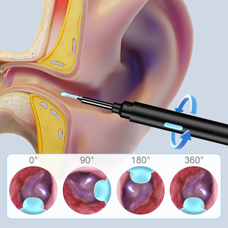 Endoscopio WiFi HD 1080P para Limpieza de Oídos