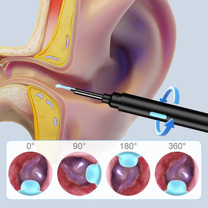Endoscopio WiFi HD 1080P para Limpieza de Oídos